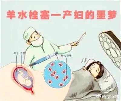 网曝刘强东妹妹因羊水栓塞去世,作为产妇“致命恶魔”的它到底有多可怕?