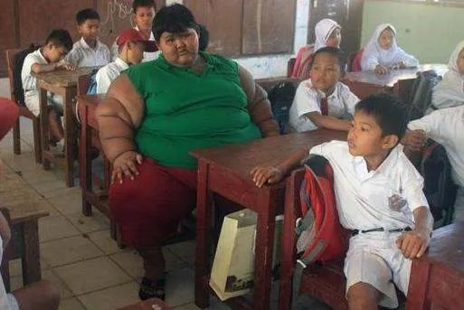 世界最胖男孩重380斤，成功减肥后留下一身赘肉，后来如何处理？