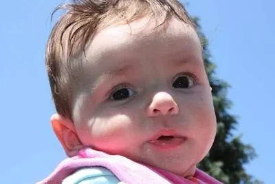 先天愚型儿新生儿照片是怎样的 先天愚型儿是什么病