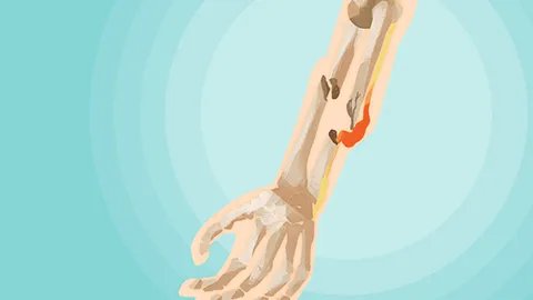 下巴关节疼是什么原因引起的