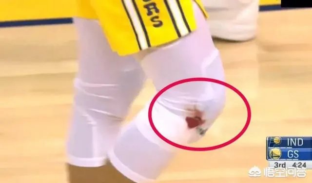 库里在和步行者比赛中膝盖流血，勇士却没有立马换下，裁判也未强制干预，这是为什么？