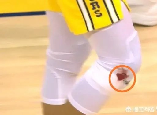 库里在和步行者比赛中膝盖流血，勇士却没有立马换下，裁判也未强制干预，这是为什么？