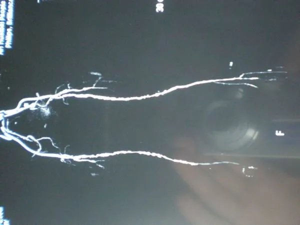 赛尔号巴多怎么抓