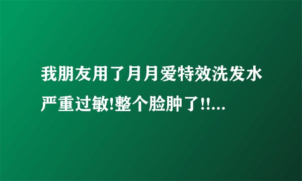 我朋友用了月月爱特效洗发水严重过敏!整个脸肿了!!!!额头和头顶的皮肤都糜烂了!!