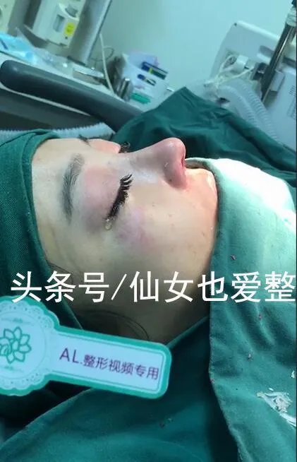 有哪些整容失败的女明星？