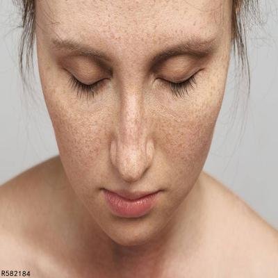 蜂蜜洗脸可以祛斑吗