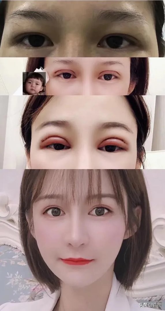 有没有因整容而感到后悔的？