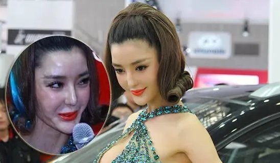 有哪些整容失败的女明星？