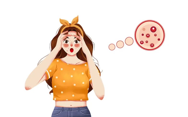 祛痘加盟大概多少钱 开一家祛痘店需要多少钱