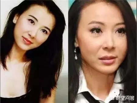 有哪些整容失败的女明星？