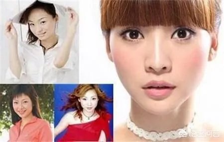 有哪些整容失败的女明星？