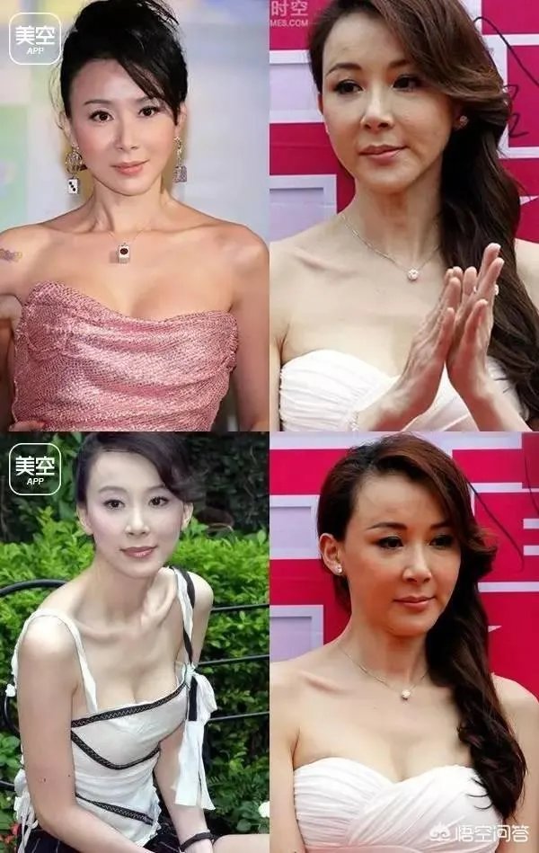 有哪些整容失败的女明星？