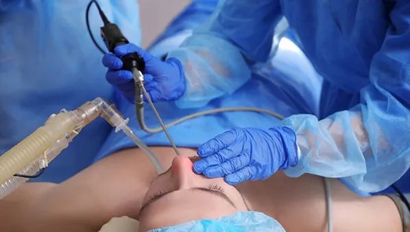 做个隆鼻手术要多少钱