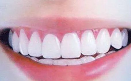 什么牙膏有美白效果