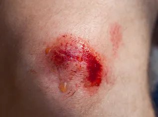 北京比较好的皮肤病医院