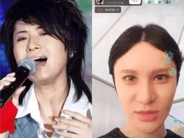 盘点娱乐圈中那些整容失败的明星都有谁？