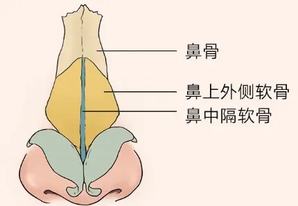 做鼻骨矫正大概需要多少钱？