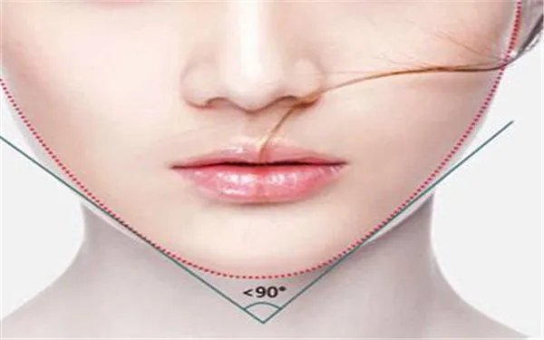 做磨骨需要多少钱