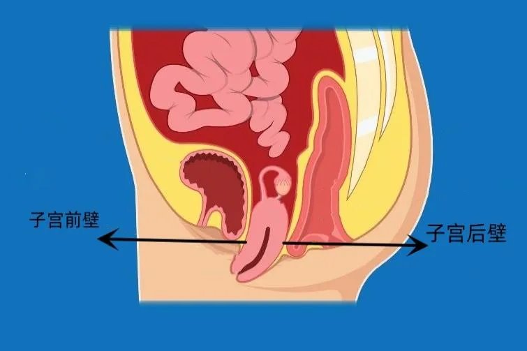 子宫前壁和后壁图