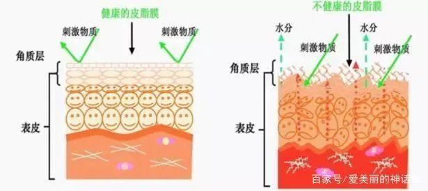 角质护理就是单纯的去角质吗？应该怎样做角质护理？