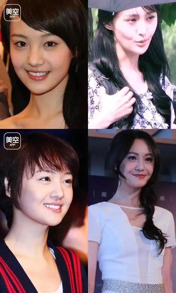 有哪些整容失败的女明星？