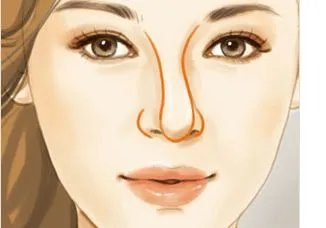 做鼻骨矫正大概需要多少钱？