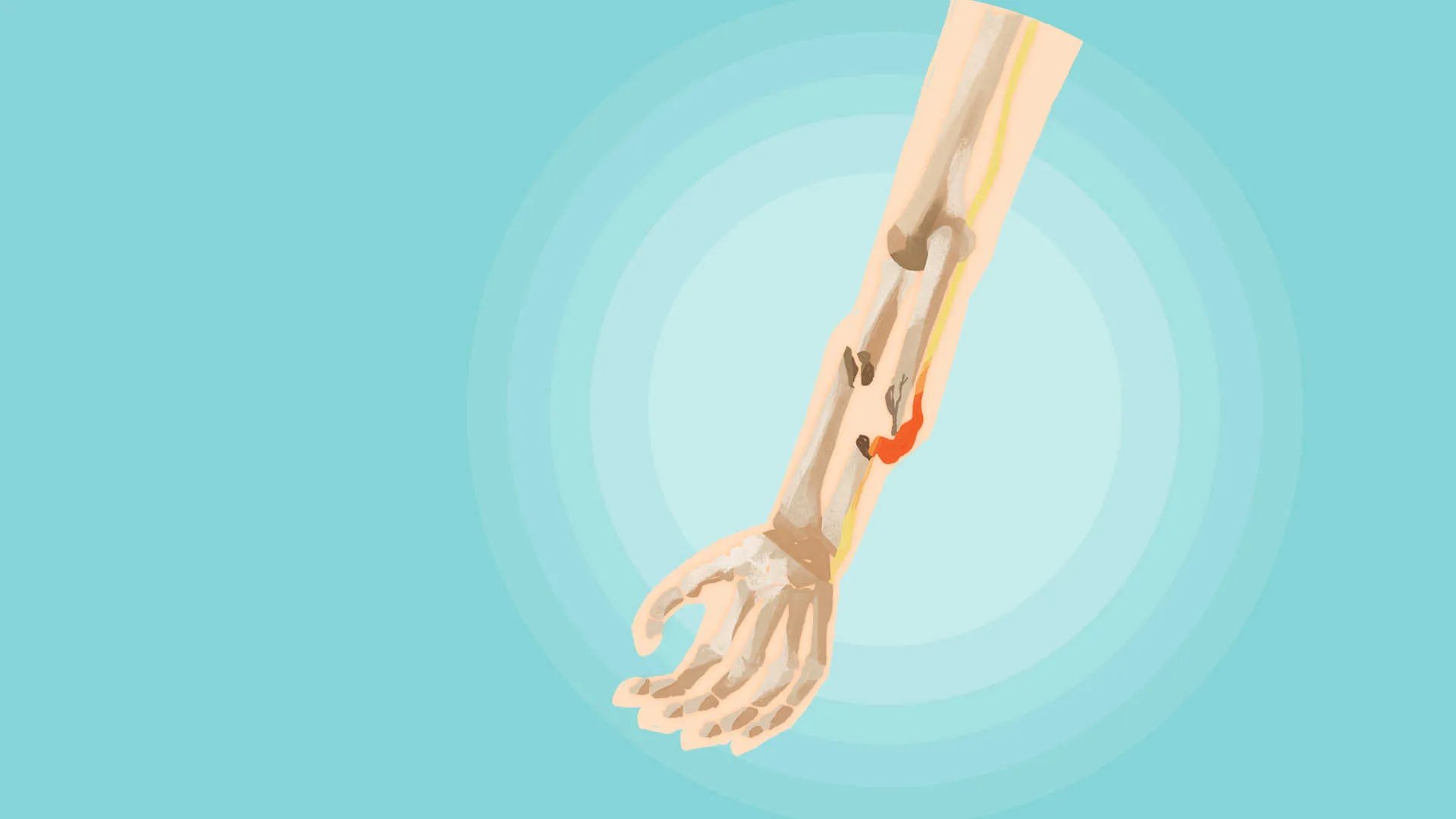 大脚骨怎么治疗