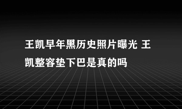 王凯早年黑历史照片曝光 王凯整容垫下巴是真的吗