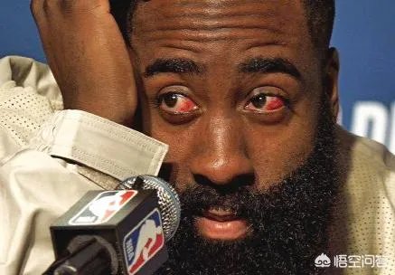 哈登的眼睛真的没事吗？