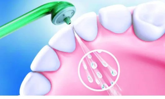 洗牙一般多少钱一次