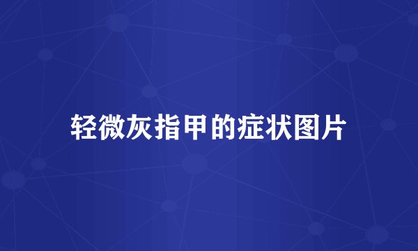 轻微灰指甲的症状图片