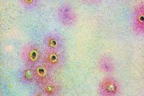 韩国报告境内首例猴痘确诊病例，上调猴痘预警级别，还采取了哪些防控措施？