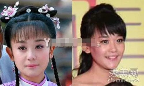 有哪些整容失败的女明星？