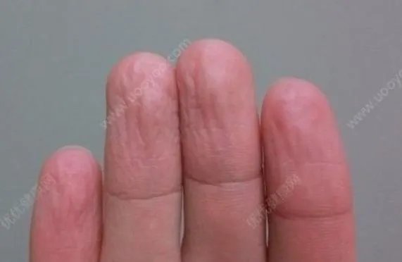 手指泡水就会起皱竟暗示这一事（图）