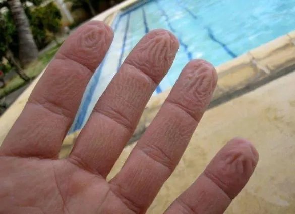 手指泡水就会起皱竟暗示这一事（图）