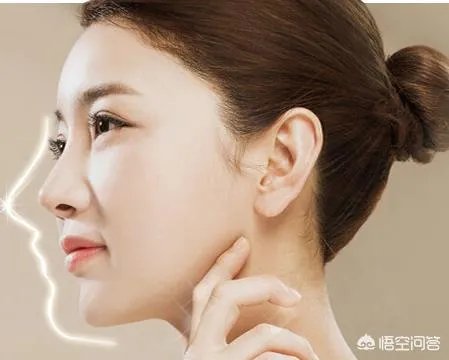 鼻部整形有哪些?