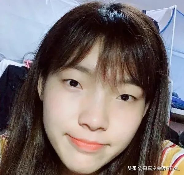 有没有因整容而感到后悔的？