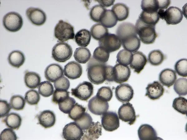 山谷热是个什么原理？