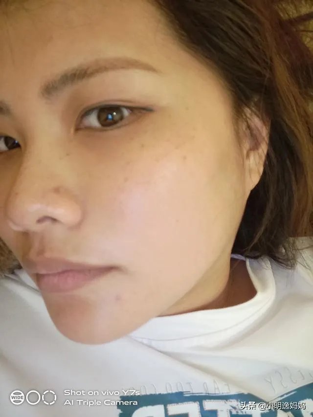 有没有因整容而感到后悔的？