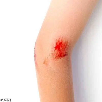 石家庄一化工厂发生闪爆事故 空气未检测出有害物质