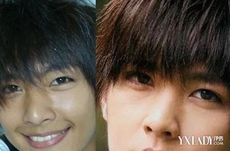 [图]汪东城爆炎亚纶整容