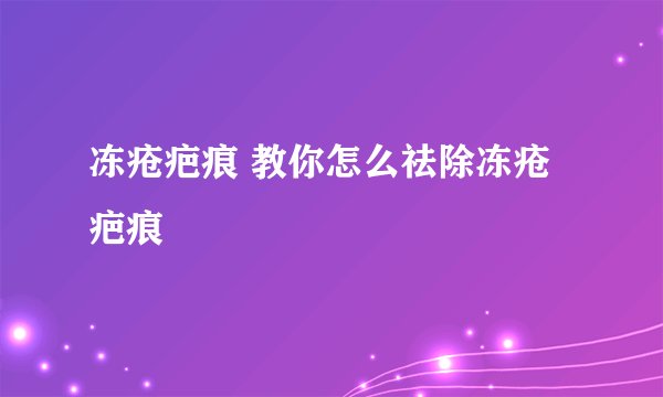 冻疮疤痕 教你怎么祛除冻疮疤痕