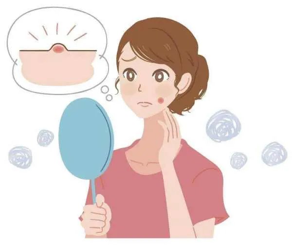 福建一男子反复挤痘出血不止引发血管瘤，有痘痘该如何正确清理？