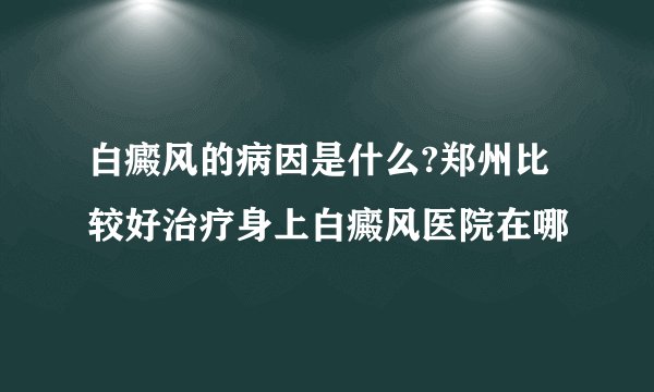 白癜风的病因是什么?郑州比较好治疗身上白癜风医院在哪