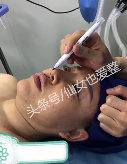 有哪些整容失败的女明星？