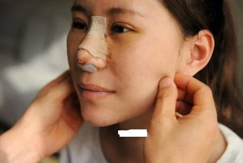 维C美容针卖23万怎么回事 揭秘医美暴利背后的真相