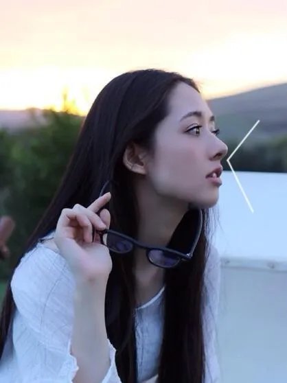 有哪些整容失败的女明星？