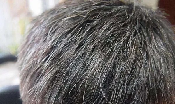 今天是元旦节2022头发白了好多朋友圈怎么发