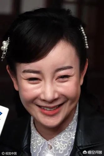 有哪些整容失败的女明星？