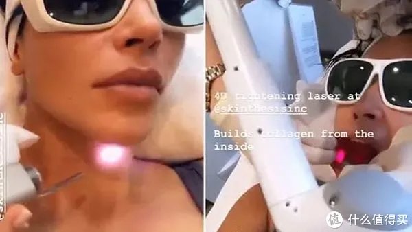 科普一个抗衰新项目，号称平价热玛吉的Fotona 4D